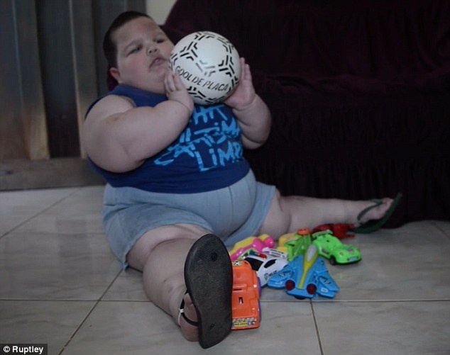 Cau be 3 tuoi nang 70kg vi mac benh la hinh anh