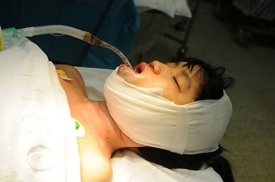 Dai phau boc khoi u quai tren guong mat 2 co gai hinh anh