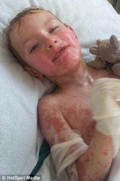 Thậm chí, phụ huynh của Stacey còn được các bác sỹ khuyến cáo rằng con trai họ có thể không qua khỏi trong thời gian ngắn.