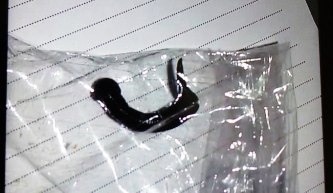 Dia song ky sinh ca thang trong thanh quan be trai hinh anh