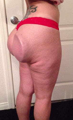 Phau thuat chinh hinh that bai: Vong 3 bet co the vo nan thanh tron hinh anh