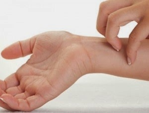 Khi mắc mày đay, bệnh nhân có cảm giác rất ngứa.
