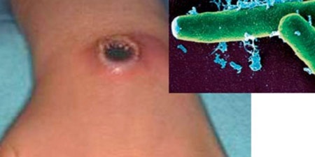 An thit gia suc chet, 9 nguoi mac benh than hinh anh