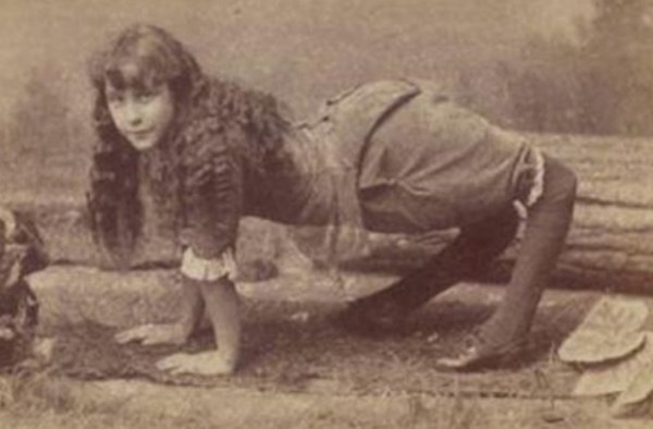 Bệnh đầu gối ngược (Genu recurvatum). Mắc phải căn bệnh kỳ quái này, người ta sẽ có một đôi chân kỳ quặc với đầu gối quay về phía lưng. Người mắc bệnh sẽ không thể đi đứng hay di chuyển bằng chân mà phải đồng thời dùng cả tay của mình để di chuyển, họ cũng thường bị gọi là quái vật. Tuy nhiên, đến này cũng cực ít người mắc phải căn bệnh kỳ quái này.