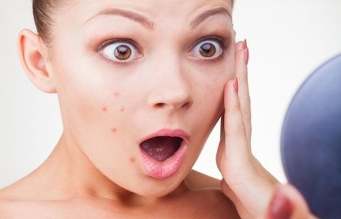 Tỏi gây kích ứng da: Allicin sinh ra khi giã tỏi sống, có thể gây kích ứng da rất mạnh (đỏ ửng, đau nhức, bỏng), nhất là khi làn da nhạy cảm hoặc tiếp xúc trực tiếp.