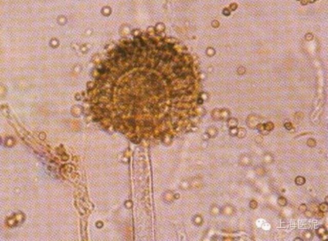 (Minh họa độc tố trong cơ thể bạn lâu ngày sẽ tích tụ lại – theo Baidu).