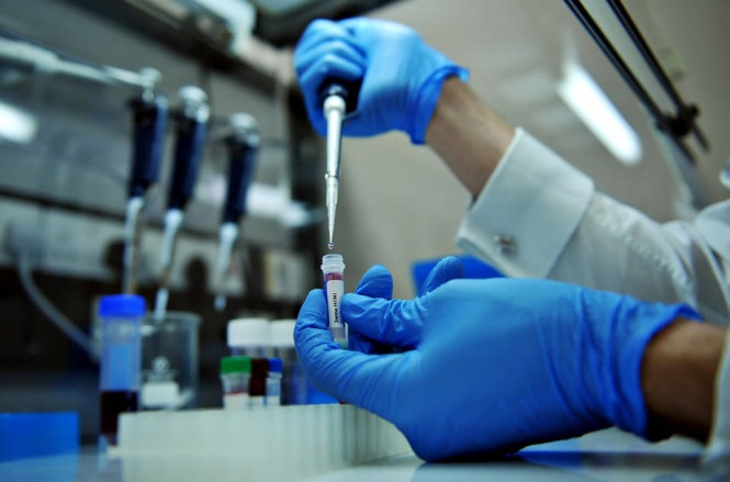 Tim ra cach moi chua HIV hinh anh