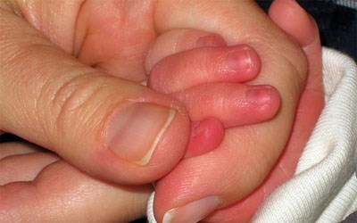 Xu ly khi bi cuoc tay chan trong ngay lanh hinh anh