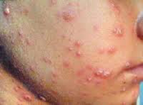 Nguoi dan ong trong 20 nam moc hon 300 khoi u nhot hinh anh