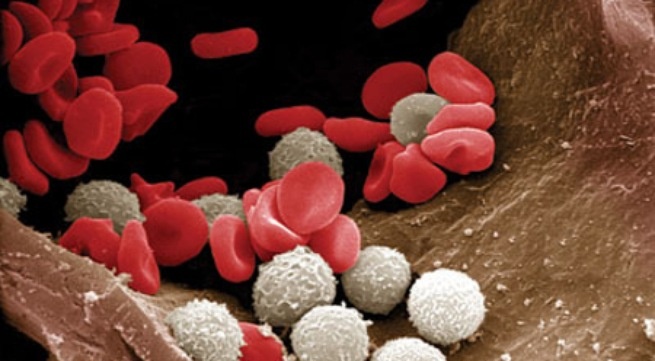 Benh bach cau cap dong tuy co thuoc chua? hinh anh