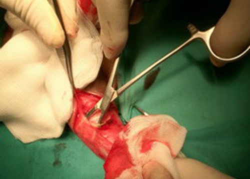 Quy ong bi kiem cong: Dau choi moi tim den bac si hinh anh