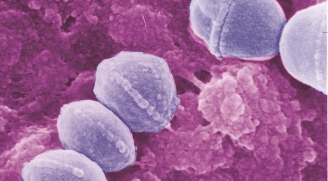 Khong nen xem thuong viem cau than cap hinh anh