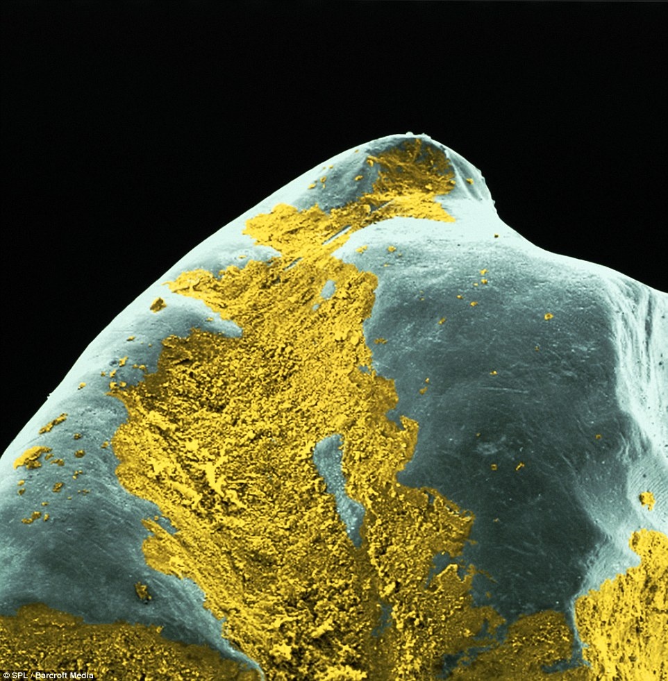 Mảng bám răng (được tô vàng) bám trên bề mặt răng (màu xanh).