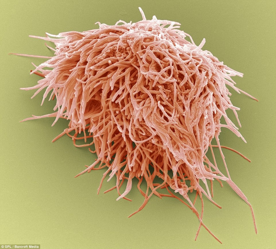 Vật này nhìn có vẻ giống một loại thực vật dưới biển, nhưng thực ra đó là hình ảnh phóng to của vi khuẩn hình thành mảng bám tích tụ trên răng.