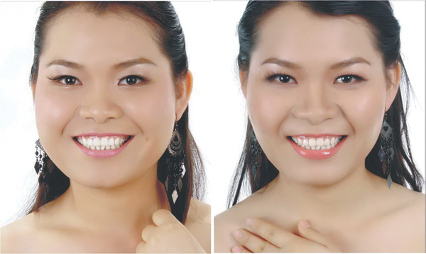 Cac phuong phap lam thon gon mat hieu qua hinh anh