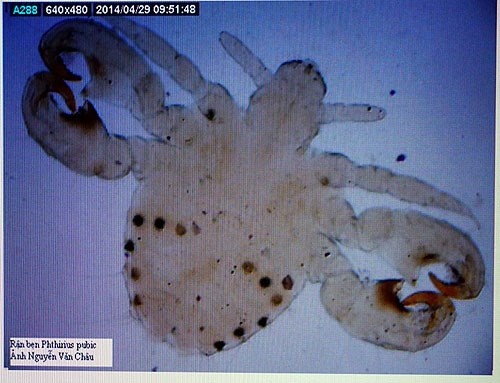 Con rận mu PGS Châu lưu giữ.