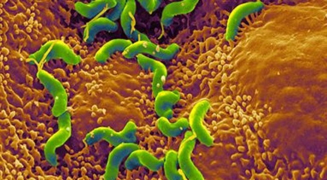 Bao dong benh loet da day - ta trang o tre em hinh anh