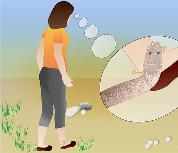 Để bệnh nhân tự đi lại sau khi bị rắn cắn. Các bác sĩ khuyến cáo không được để bệnh nhân tự đi lại. Trong hầu hết các trường hợp, các bác sĩ cho biết, nọc độc xâm nhập vào cơ thể theo con đường mạch bạch huyết (không phải mạch máu thông thường). Con đường vận chuyển nọc độc này sẽ trở nên nhanh hơn và nhiều hơn khi cơ thể vận động. Nếu nạn nhân, đặc biệt vùng cơ thể bị cắn không hạn chế vận động thì nọc sẽ xâm nhập nhanh hơn.