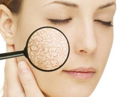 Nên cung cấp đủ nước cho da để da được mịn màng, không khô ráp. Hình minh họa.
