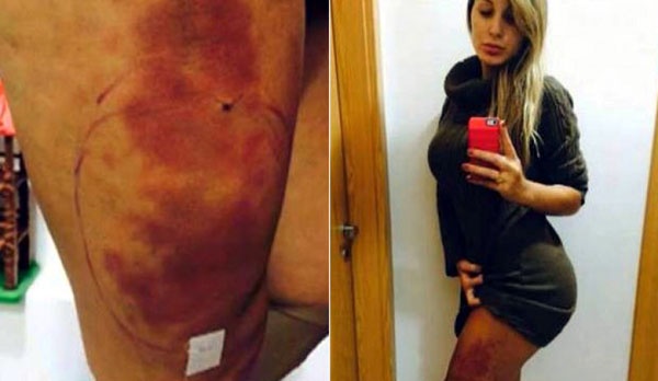 Nguoi tinh tin don cua Ronaldo suyt chet vi tham my hinh anh