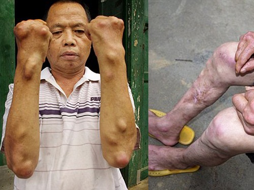 Lang toan 'di nhan' vi song trong o nhiem hinh anh