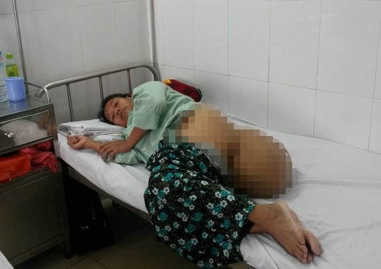 Nguoi phu nu 39 tuoi mang khoi u khong lo suot 10 nam hinh anh