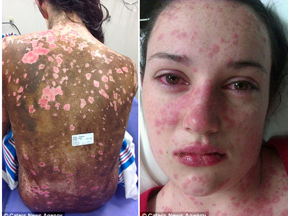 Thieu nu xinh dep bong nang vi thuoc dong kinh hinh anh