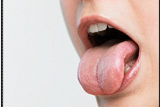 Nhan biet tinh trang suc khoe qua luoi hinh anh