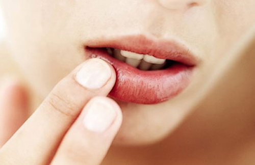 Môi khô và nứt nẻ là hiện tượng thường gặp trong mùa đông lạnh.