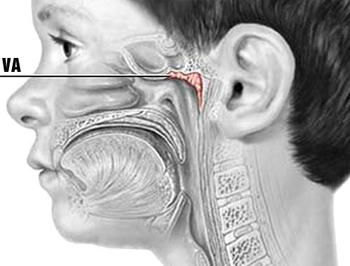 Vị trí của V.A.