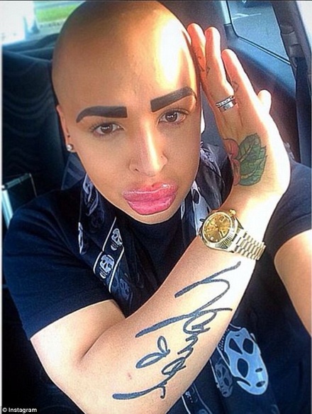 Jordan đã trải qua hơn 50 cuộc phẫu thuật để bơm môi, gọt cằm, làm lông mày... 