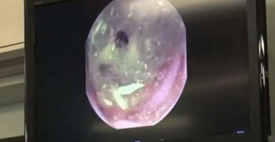 Ky sinh trung dai 2m trong co the nguoi 4 nam hinh anh