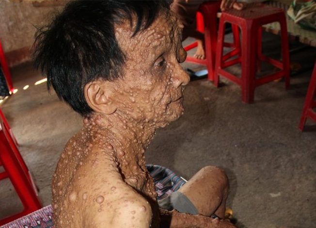 Buou moc khap nguoi hinh anh