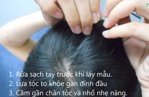 Huong dan cach lay mau toc lam xet nghiem ADN hinh anh