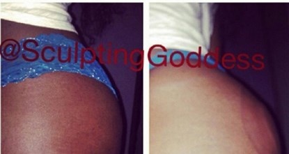 Ảnh quảng cáo về công dụng của liệu pháp hút chân không tăng kich thước vòng 3.