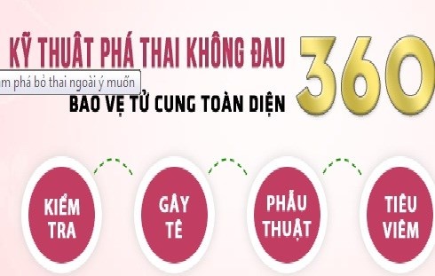 Một mẫu quảng cáo về công nghệ phá thai không đau.