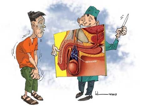 Khi bệnh tiến triển nhanh gây đau đớn, bệnh nhân cần được phẫu thuật để thắt các tĩnh mạch giãn.