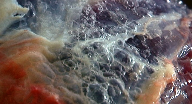 Thịt bò bơm nước sùi bọt, chảy nước sau vài tiếng.