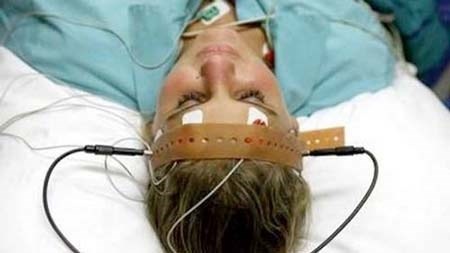 Như trên đã nói, chứng cuồng dâm còn gặp ở các bệnh nhân Alzheimer, Parkinson và liệt tiến triển. Ở các bệnh nhân này, cuồng dâm thường gắn liền với mất trí, cuồng dâm được coi là hiện tượng giải phóng bản năng khi thần kinh cấp cao không còn đủ khả năng kiểm soát các bản năng tình dục. Hiện nay chưa có giải pháp điều trị hiệu quả cho các bệnh nhân này.