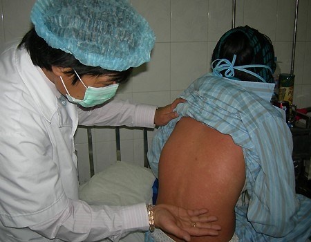 Xuat hien o dich rubella tai Binh Duong: 138 ca nghi nhiem hinh anh