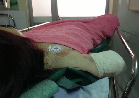 Benh nhan Campuchia di may bay sang Viet Nam cap cuu hinh anh