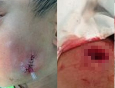 Nga vao goc cay kho, mat be trai bi hoai tu hinh anh