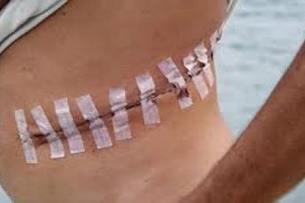 Theo tiết lộ của nhà báo Scott Carney, người nghiên cứu và viết một cuốn sách về thị trường chợ đen, sau trận động đất năm 2004, ở Ấn Độ có một ngôi làng chuyên bán thận để có tiền tồn tại. Số lượng thận bất hợp pháp này nhằm phục vụ giới giàu có.