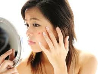 Meo don gian de mun khong xuat hien ngay den do hinh anh
