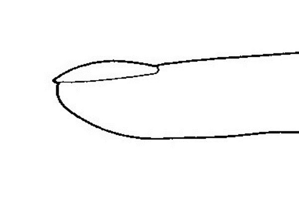 Móng tay cong. Tình trạng móng tay này tức là cơ thể bạn có ít các tế bào hồng cầu do thiếu sắt hoặc có thể bạn bị bệnh Raynaud, ảnh hưởng đến cung cấp máu cho các ngón tay và ngón chân khiến chúng chuyển sang màu trắng.