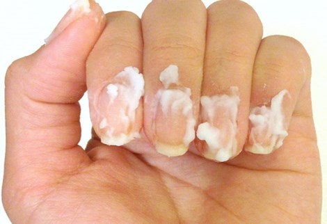 Baking soda giúp tẩy trắng móng rất hiệu quả. Hình minh họa.