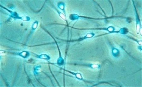 Giai ma hien tuong tinh dich von cuc hinh anh