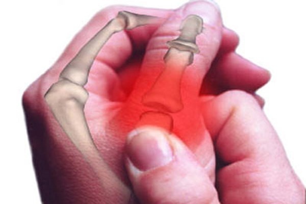 6. Viêm. Cơ thể luôn bảo vệ lợi ích tổng thể, và nó sẽ tập trung các loại virus và vi khuẩn lại một chỗ, tạo phản ứng đau đớn và sưng lên. Nếu như cứ dùng thuốc kháng sinh và chống viêm, vô tình sẽ đánh tan cụm vi khuẩn này và có một số con vẫn sống sót lạc vào các bộ phận khác dẫn đến giai đoạn thứ 7. Bạn nên tránh bước thứ 6 này bằng biện pháp tự nhiên như các loại thực phẩm chống viêm hoặc massage, các liệu pháp thể dục...