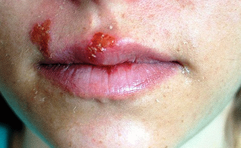 Mang hoa vi xam moi cap toc hinh anh