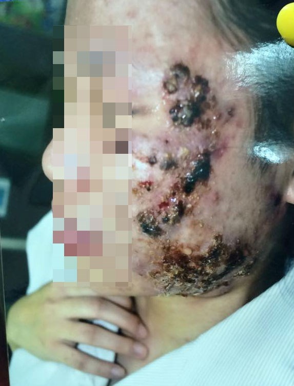 Hình ảnh của bệnh nhân Hải.